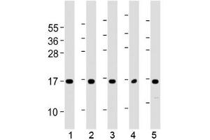 Western blot testing of human 1) 293T/17, 2) HUVEC, 3) K562, 4) NCI-H460 and 5) PC-3 cell lysate with Eotaxin-3 antibody at 1:2000. (CCL26 抗体  (AA 58-92))