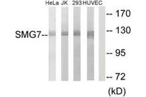 Western blot analysis of extracts from HeLa/Jurkat/293/HuvEc cells, using SMG7 Antibody. (SMG7 抗体  (AA 521-570))