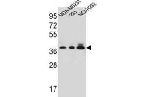 Western Blotting (WB) image for anti-Taste Receptor, Type 2, Member 1 (TAS2R1) antibody (ABIN2997059) (TAS2R1 抗体)