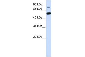 SMARCD1 antibody used at 1 ug/ml to detect target protein. (SMARCD1 抗体  (Middle Region))