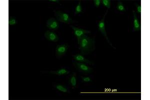 Immunofluorescence of monoclonal antibody to NR4A2 on HeLa cell. (NR4A2 抗体  (AA 71-170))