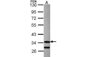 WB Image Sample (30 ug of whole cell lysate) A: Hep G2 , 10% SDS PAGE Cdk3 antibody antibody diluted at 1:1000 (CDKL3 抗体)