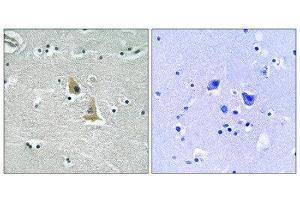 Immunohistochemistry (IHC) image for anti-Neutrophil Cytosol Factor 1 (NCF1) (Ser345) antibody (ABIN1848360) (NCF1 抗体  (Ser345))