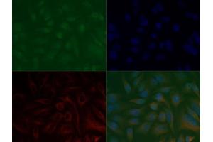 Immunofluorescence of Anti-Histone H3 K37 me3: Histone H3 trimethyl Lys37 antibody was tested at 1:100,000 in HeLa cells with FITC (green).