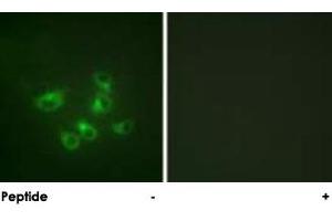 Immunofluorescence analysis of HepG2 cells, using TPH1 polyclonal antibody . (Tryptophan Hydroxylase 1 抗体  (AA 25-75))