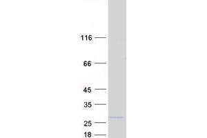 Cytokine Induced Apoptosis Inhibitor 1 (CIAPIN1) protein (Myc-DYKDDDDK Tag)
