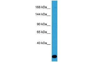 Host: Rabbit Target Name: ZC3H13 Sample Type: Jurkat Whole Cell lysates Antibody Dilution: 1. (ZC3H13 抗体  (C-Term))