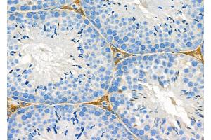 ABIN6263482 and ABIN6279565 at 1/100 staining Mouse testis tissue by IHC-P. (MYO5C 抗体  (Internal Region))