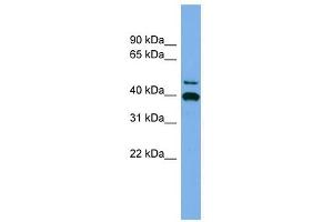 FGL2 antibody used at 1 ug/ml to detect target protein.