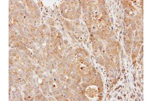 IHC-P Image Immunohistochemical analysis of paraffin-embedded N87 xenograft, using PDE9A, antibody at 1:500 dilution. (PDE9A 抗体  (N-Term))