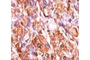 Immunohistochemistry (IHC) image for anti-Retinoblastoma Protein (Rb Protein) (pSer811) antibody (ABIN3029756)