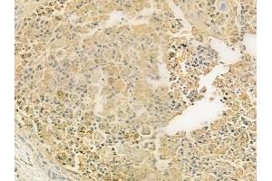anti-RAB Interacting Factor (RABIF) (N-Term) antibody
