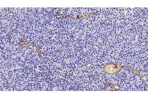 Immunohistochemistry (IHC) image for anti-Collagen, Type I, alpha 1 (COL1A1) (AA 1218-1440) antibody (ABIN7425806)