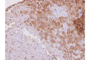 IHC-P Image HSD3B2 antibody detects HSD3B2 protein at cytosol on human normal liver by immunohistochemical analysis. (HSD3B2 抗体)