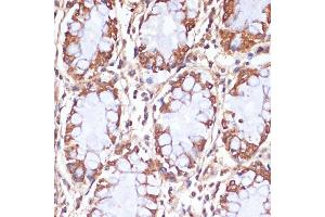 Immunohistochemistry (IHC) image for anti-Carnitine Palmitoyltransferase 1B (Muscle) (CPT1B) (AA 533-772) antibody (ABIN6138978)