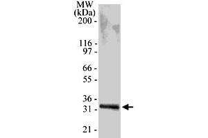 Western blot analysis of 0. (TACI 抗体  (AA 116-132))