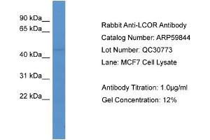 WB Suggested Anti-LCOR  Antibody Titration: 0. (Lcor 抗体  (C-Term))