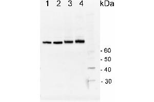 Image no. 2 for anti-Heat Shock Protein 70 (HSP70) (Cytoplasmic) antibody (ABIN334584) (HSP70 抗体  (Cytoplasmic))
