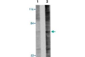 Western blot analysis of Gle1 in 293 cell lysate with Gle1 polyclonal antibody  at (A) 1 and (B) 2 ug/mL . (GLE1 抗体  (Internal Region))