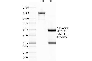 SDS-PAGE Analysis Purified vWF Monoclonal Antibody (VWF/1767). (VWF 抗体  (AA 1815-1939))