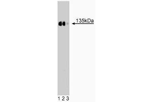 Western blot analysis of CD49c (integrin alpha3) on a rat kidney lysate. (ITGA3 抗体  (AA 110-325))