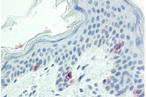 Human Skin (formalin-fixed, paraffin-embedded) stained with TYR antibody ABIN573956 at 10 ug/ml followed by biotinylated anti-mouse IgG secondary antibody ABIN481714, alkaline phosphatase-streptavidin and chromogen. (TYR 抗体  (AA 1-433))