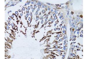 Immunohistochemistry (Paraffin-embedded Sections) (IHC (p)) image for anti-Actin, beta (ACTB) antibody (ABIN3020544)