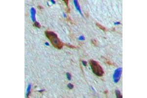 Immunohistochemical analysis of MSK1 staining in human brain formalin fixed paraffin embedded tissue section. (MSK1 抗体  (Center))