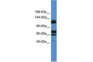 Image no. 1 for anti-Suppression of Tumorigenicity 5 (ST5) (AA 387-436) antibody (ABIN6746819) (ST5 抗体  (AA 387-436))