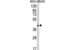 Western Blotting (WB) image for anti-1-Acylglycerol-3-Phosphate O-Acyltransferase 4 (AGPAT4) antibody (ABIN3003878)