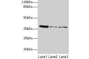 Western blot All lanes: MAS1 antibody at 2 μg/mL Lane 1: 293T whole cell lysate Lane 2: Colo320 whole cell lysate Lane 3: HepG2 whole cell lysate Secondary Goat polyclonal to rabbit IgG at 1/10000 dilution Predicted band size: 38 kDa Observed band size: 38 kDa
