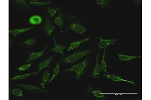Immunofluorescence of purified MaxPab antibody to PDK4 on HeLa cell. (PDK4 抗体  (AA 1-411))
