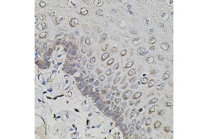 Immunohistochemistry of paraffin-embedded human esophagus using APP antibody (ABIN3020679, ABIN3020680, ABIN3020681 and ABIN6213663) at dilution of 1:100 (40x lens). (APP 抗体  (AA 190-290))