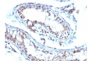 Immunohistochemistry (IHC) image for anti-Moesin (MSN) antibody (ABIN6940085)