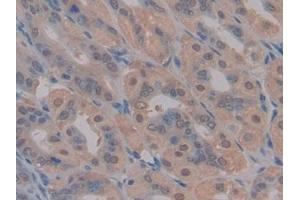 Immunohistochemistry (IHC) image for anti-Pyruvate Dehydrogenase Kinase, Isozyme 2 (PDK2) (AA 155-379) antibody (ABIN7439423)