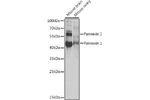 Western blot analysis of extracts of various cell lines, using Pannexin 1 antibody (ABIN6128523, ABIN6145204, ABIN6145206 and ABIN6217644) at 1:1000 dilution. (PANX1 抗体  (AA 297-426))