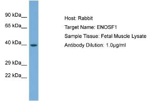 Host: Rabbit Target Name: ENOSF1 Sample Type: Fetal Muscle lysates Antibody Dilution: 1. (ENOSF1 抗体  (Middle Region))