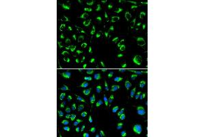 Immunofluorescence analysis of MCF-7 cells using PPP4C antibody. (PPP4C 抗体)