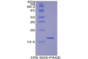 SDS-PAGE analysis of Cow Lysozyme Protein. (LYZ 蛋白)
