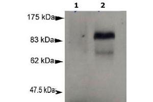 Detection of Prdm1 in murine plasmacytoma cell lysate (P3X) using Prdm1 monoclonal antibody, clone 3H2-E8 . (PRDM1 抗体  (AA 199-409))