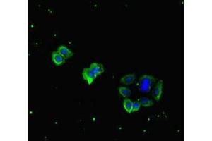 Immunofluorescent analysis of HepG2 cells using ABIN7177754 at dilution of 1:100 and Alexa Fluor 488-congugated AffiniPure Goat Anti-Rabbit IgG(H+L) (PDGFD 抗体  (AA 24-370))