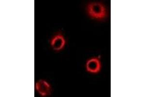 Immunofluorescent analysis of ArgRS staining in MCF7 cells. (ArgRS 抗体)