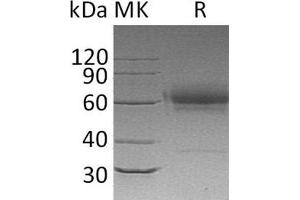 Western Blotting (WB) image for CD27 Molecule (CD27) protein (His tag,Fc Tag) (ABIN7320754) (CD27 Protein (His tag,Fc Tag))