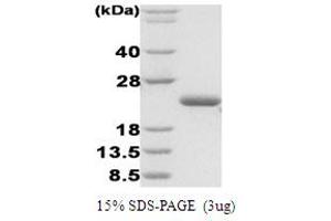 SDS-PAGE (SDS) image for Disulfide Oxidoreductase (DsbA) protein (ABIN666855) (Disulfide Oxidoreductase (DsbA) 蛋白)