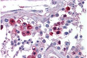 Human Testis: Formalin-Fixed, Paraffin-Embedded (FFPE) (SKA3 抗体  (C-Term))