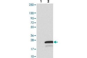 Western blot analysis of Lane 1: Negative control (vector only transfected HEK293T lysate). (TMEM138 抗体)
