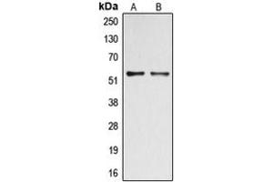 Western blot analysis of DOK2 (pY299) expression in A549 Insulin-treated (A), HepG2 (B) whole cell lysates. (DOK2 抗体  (pTyr299))