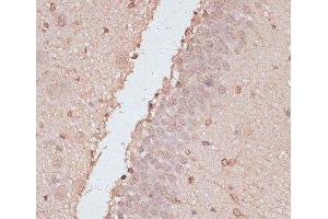 Immunohistochemistry of paraffin-embedded Rat brain using HSF1 Polyclonal Antibody at dilution of 1:100 (40x lens). (HSF1 抗体)