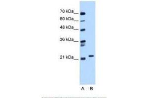 Image no. 1 for anti-RAB11B, Member RAS Oncogene Family (RAB11B) (C-Term) antibody (ABIN6738434) (RAB11B 抗体  (C-Term))