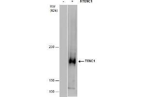 WB Image TENC1 antibody detects TENC1 protein by western blot analysis. (TENC1 抗体  (C-Term))